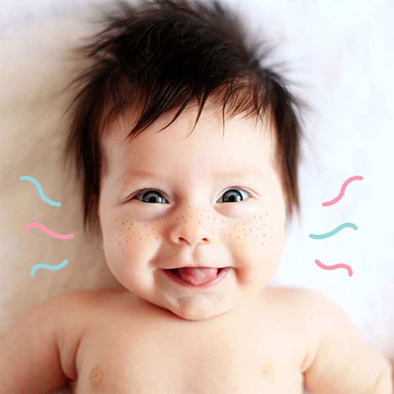 When Do Babies Get Freckles: Know the Reasons