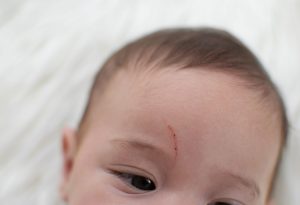 Read more about the article When Do Babies Stop Scratching Their Face