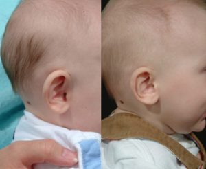 Read more about the article When Does Baby Ear Cartilage Harden: Explore the Truth