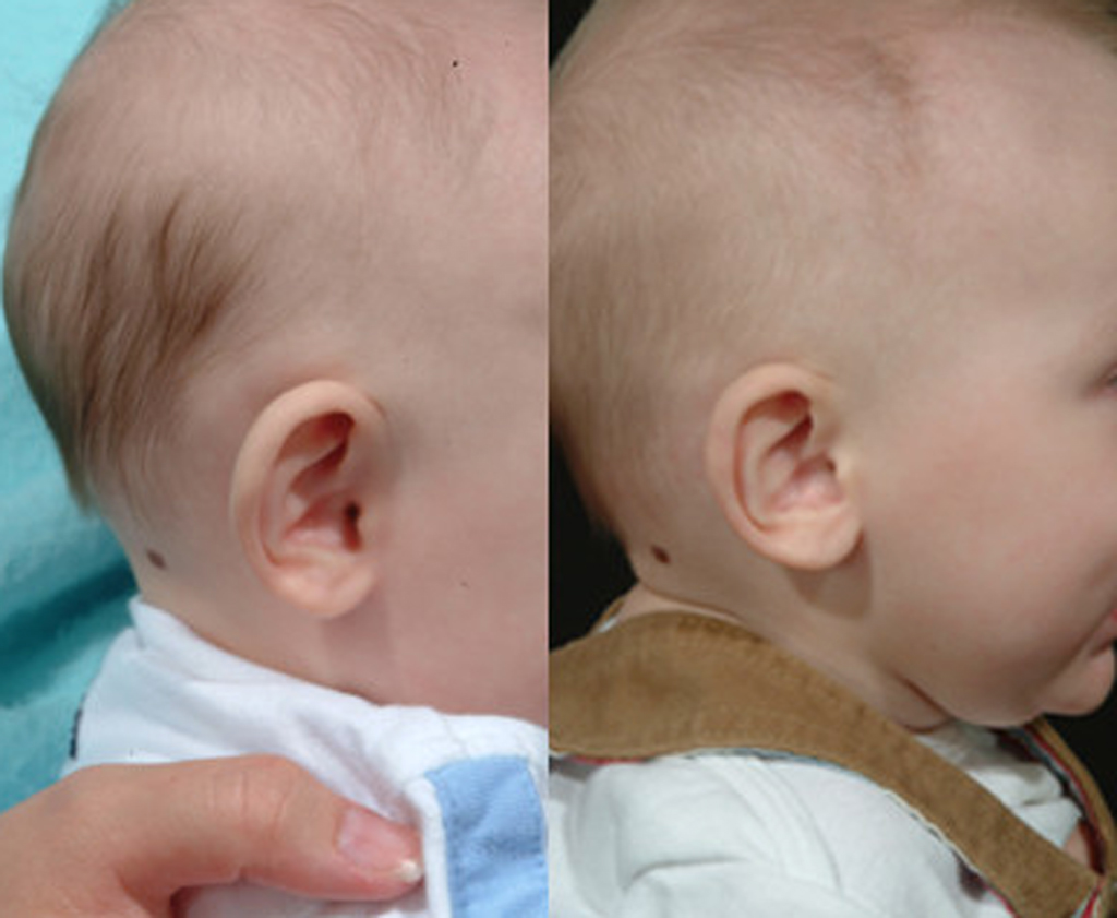 You are currently viewing When Does Baby Ear Cartilage Harden: Explore the Truth