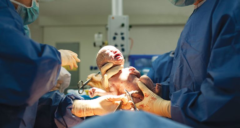 Do Doctors Spank Babies When They Are Born