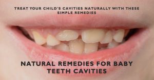 Read more about the article How to Treat Cavities in Baby Teeth Naturally