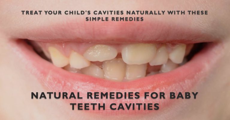 How to Treat Cavities in Baby Teeth Naturally