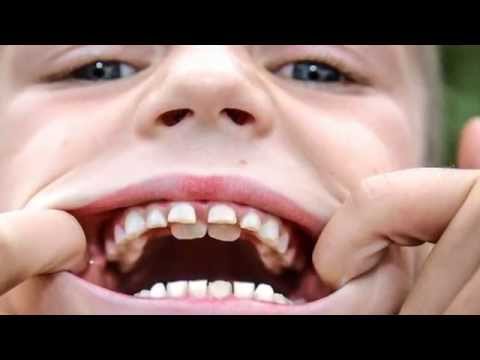 You are currently viewing The Truth About Babies’ Teeth: Two Sets or One?