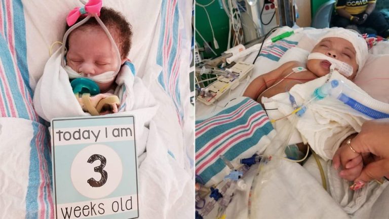 The Miracle of Life: What a 25 Week Baby Looks Like