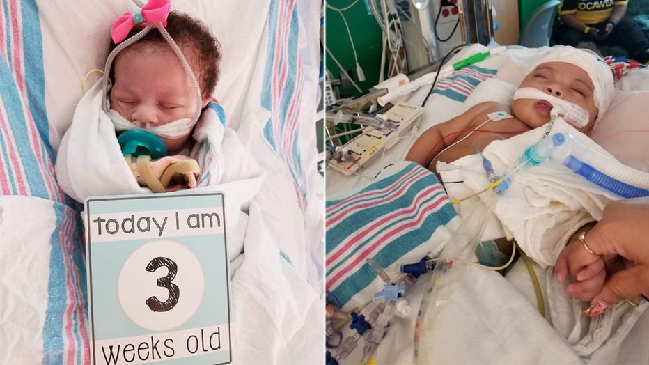You are currently viewing The Miracle of Life: What a 25 Week Baby Looks Like